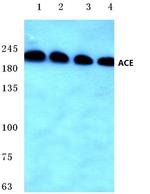 ACE Antibody in Western Blot (WB)