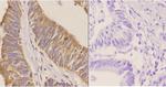 CD171 Antibody in Immunohistochemistry (Paraffin) (IHC (P))