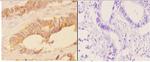 ACAT1 Antibody in Immunohistochemistry (Paraffin) (IHC (P))