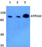 SERCA2 ATPase Antibody in Western Blot (WB)