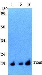 CD49e (Integrin alpha 5) Antibody in Western Blot (WB)