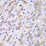 Cathepsin D Antibody in Immunohistochemistry (Paraffin) (IHC (P))