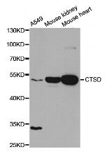 Cathepsin D Antibody in Western Blot (WB)