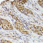 COX2 Antibody in Immunohistochemistry (Paraffin) (IHC (P))