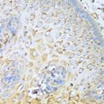 MYH9 Antibody in Immunohistochemistry (Paraffin) (IHC (P))