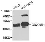 CD200R Antibody in Western Blot (WB)