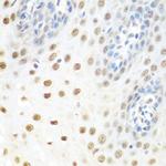 UAP56 Antibody in Immunohistochemistry (Paraffin) (IHC (P))