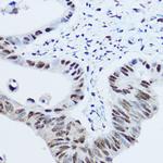 hnRNP H1 Antibody in Immunohistochemistry (Paraffin) (IHC (P))