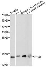 S100P Antibody in Western Blot (WB)