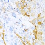 HAI-1 Antibody in Immunohistochemistry (Paraffin) (IHC (P))