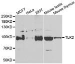 TLK2 Antibody in Western Blot (WB)