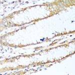 MYH9 Antibody in Immunohistochemistry (Paraffin) (IHC (P))