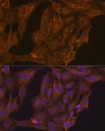 RARA Antibody in Immunocytochemistry (ICC/IF)