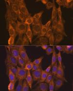 RARA Antibody in Immunocytochemistry (ICC/IF)