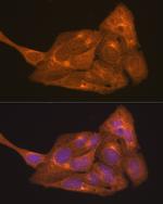 RARA Antibody in Immunocytochemistry (ICC/IF)