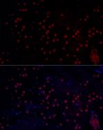 n-Myc Antibody in Immunohistochemistry (Paraffin) (IHC (P))