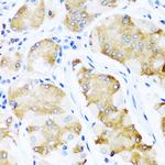 ACVR1C Antibody in Immunohistochemistry (Paraffin) (IHC (P))