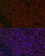 BMP-7 Antibody in Immunocytochemistry (ICC/IF)