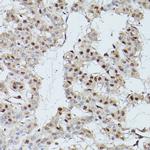 CDK9 Antibody in Immunohistochemistry (Paraffin) (IHC (P))