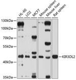 KIR3DL2 Antibody in Western Blot (WB)