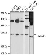 MESP1 Antibody in Western Blot (WB)