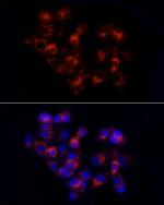 alpha-1 Antitrypsin Antibody in Immunocytochemistry (ICC/IF)