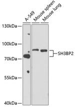 SH3BP2 Antibody in Western Blot (WB)