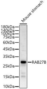 RAB27B Antibody in Western Blot (WB)