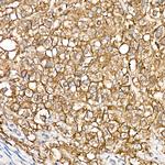 ZIP14 Antibody in Immunohistochemistry (Paraffin) (IHC (P))