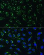 AKR1C2 Antibody in Immunocytochemistry (ICC/IF)