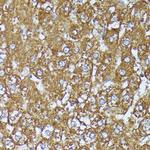 AKR1C2 Antibody in Immunohistochemistry (Paraffin) (IHC (P))