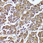 AKR1C2 Antibody in Immunohistochemistry (Paraffin) (IHC (P))