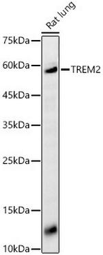 TREM2 Antibody in Western Blot (WB)