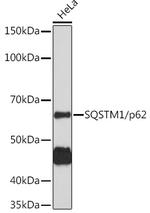 SQSTM1 Antibody in Western Blot (WB)