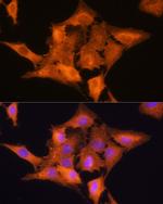 Aldolase C Antibody in Immunocytochemistry (ICC/IF)