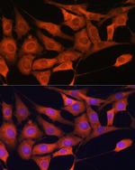 Aldolase C Antibody in Immunocytochemistry (ICC/IF)