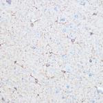 Aldolase C Antibody in Immunohistochemistry (Paraffin) (IHC (P))