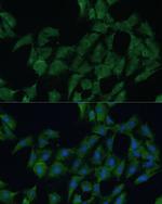 DDX3Y Antibody in Immunocytochemistry (ICC/IF)