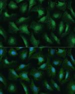 DDX3Y Antibody in Immunocytochemistry (ICC/IF)