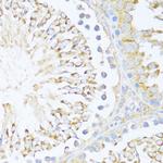 DDX3Y Antibody in Immunohistochemistry (Paraffin) (IHC (P))