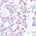 ISG15 Antibody in Immunohistochemistry (Paraffin) (IHC (P))