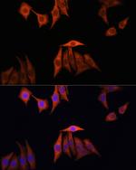 K-Ras Antibody in Immunocytochemistry (ICC/IF)