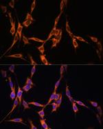 K-Ras Antibody in Immunocytochemistry (ICC/IF)