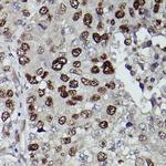 JMJD1A Antibody in Immunohistochemistry (Paraffin) (IHC (P))