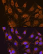 SEL1L Antibody in Immunocytochemistry (ICC/IF)