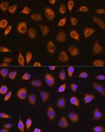 SEL1L Antibody in Immunocytochemistry (ICC/IF)