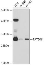 TATDN1 Antibody in Western Blot (WB)