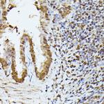 hnRNP L Antibody in Immunohistochemistry (Paraffin) (IHC (P))