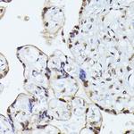 hnRNP L Antibody in Immunohistochemistry (Paraffin) (IHC (P))