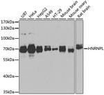 hnRNP L Antibody in Western Blot (WB)